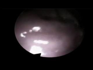 Vaginal Cam - Filmed From The Inside During Sex